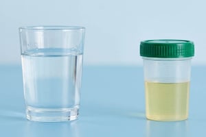 Bild zum Kurs Fachaustausch zum Thema "Miktionsprotokoll"