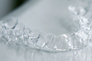 aesthetic liner® - die transparente Zahnkorrekturschiene